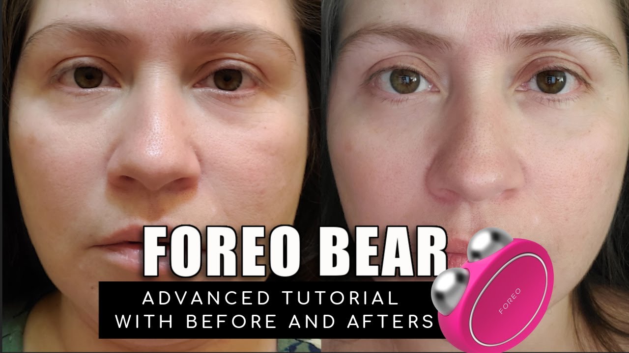 FOREO BEAR | BEFORE & AFTERS, ADVANCED TUTORIAL AND TIPS TO GET THE BEST RESULTS