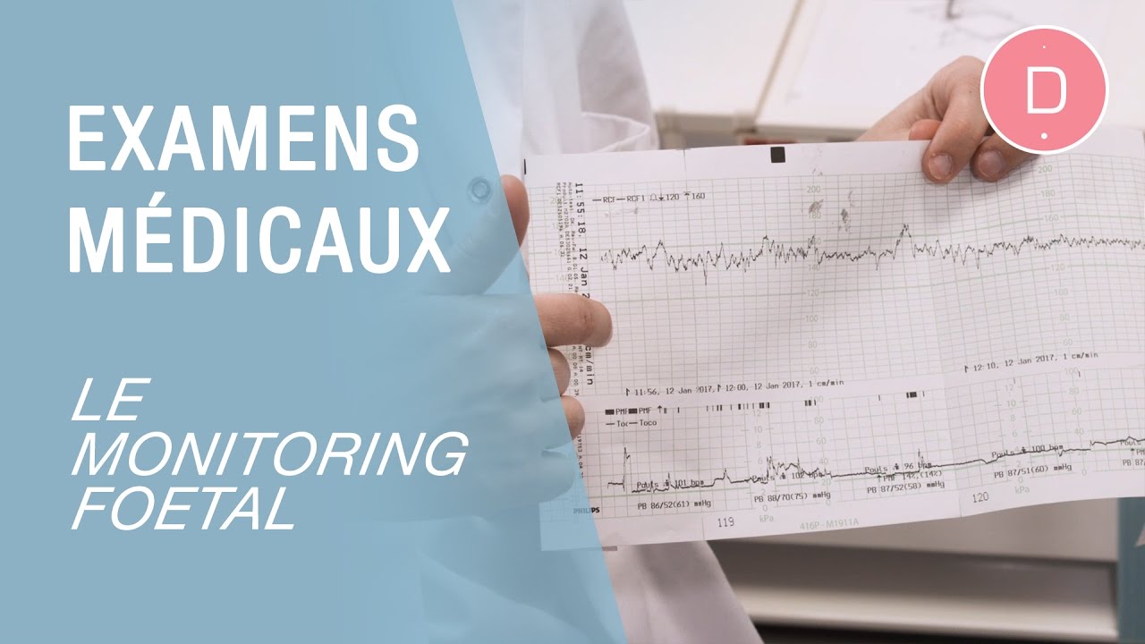 A quoi sert le monitoring foetal ? - Examens grossesse
