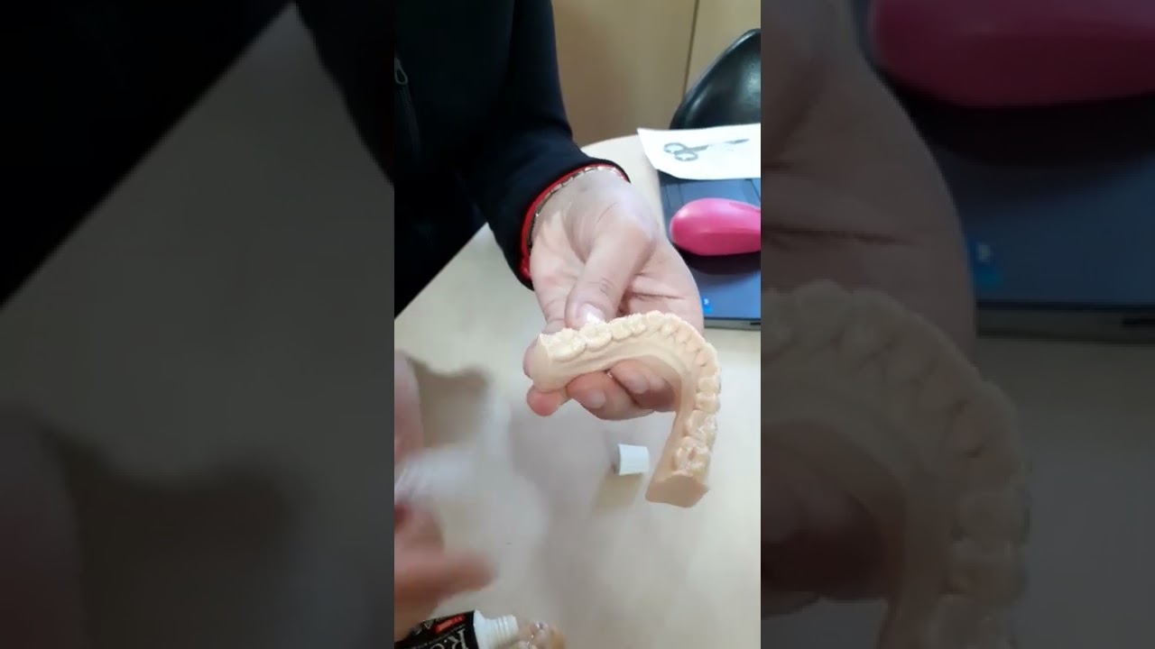 כך משתמשים בסדי מינרליזציה | דר שרית אברהם מסבירה
