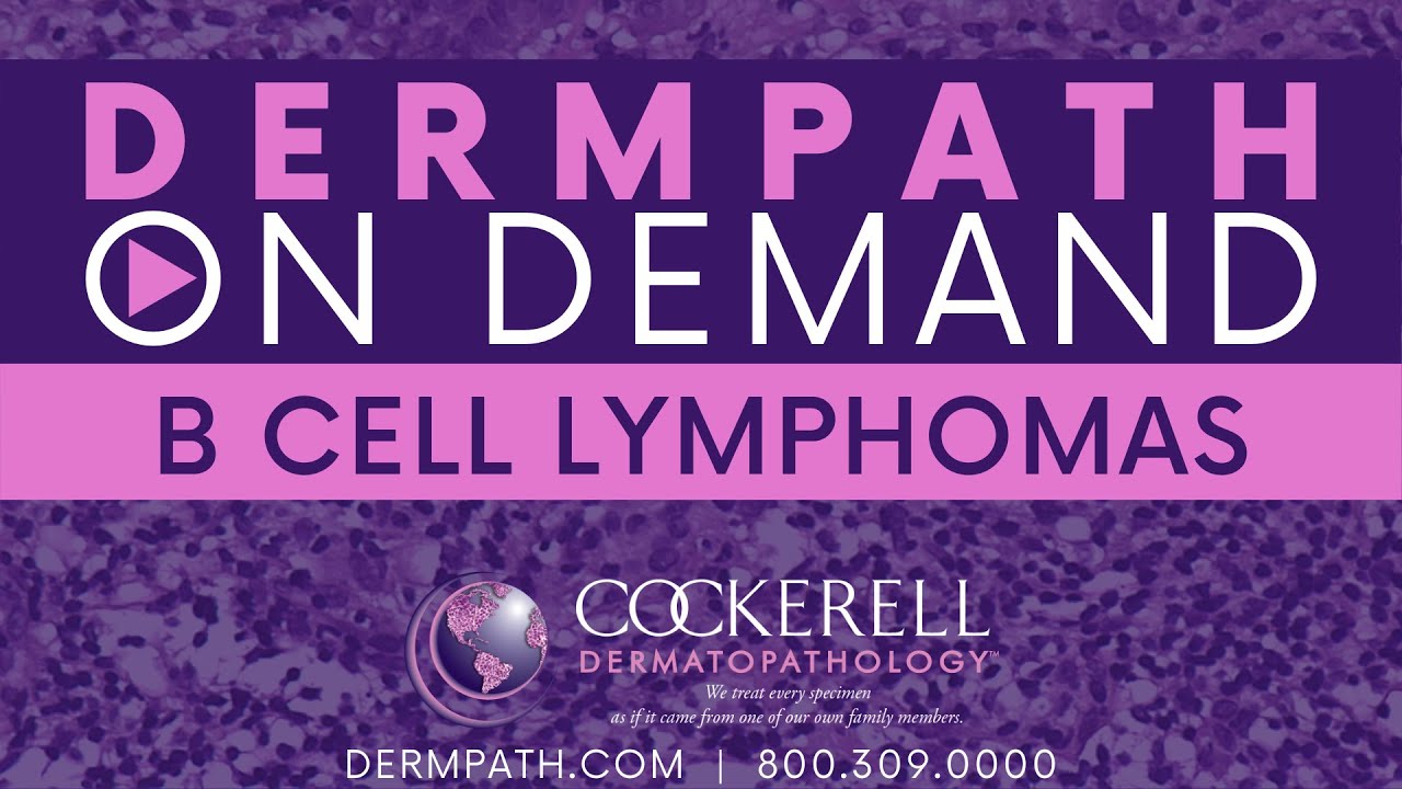 B Cell Lymphomas
