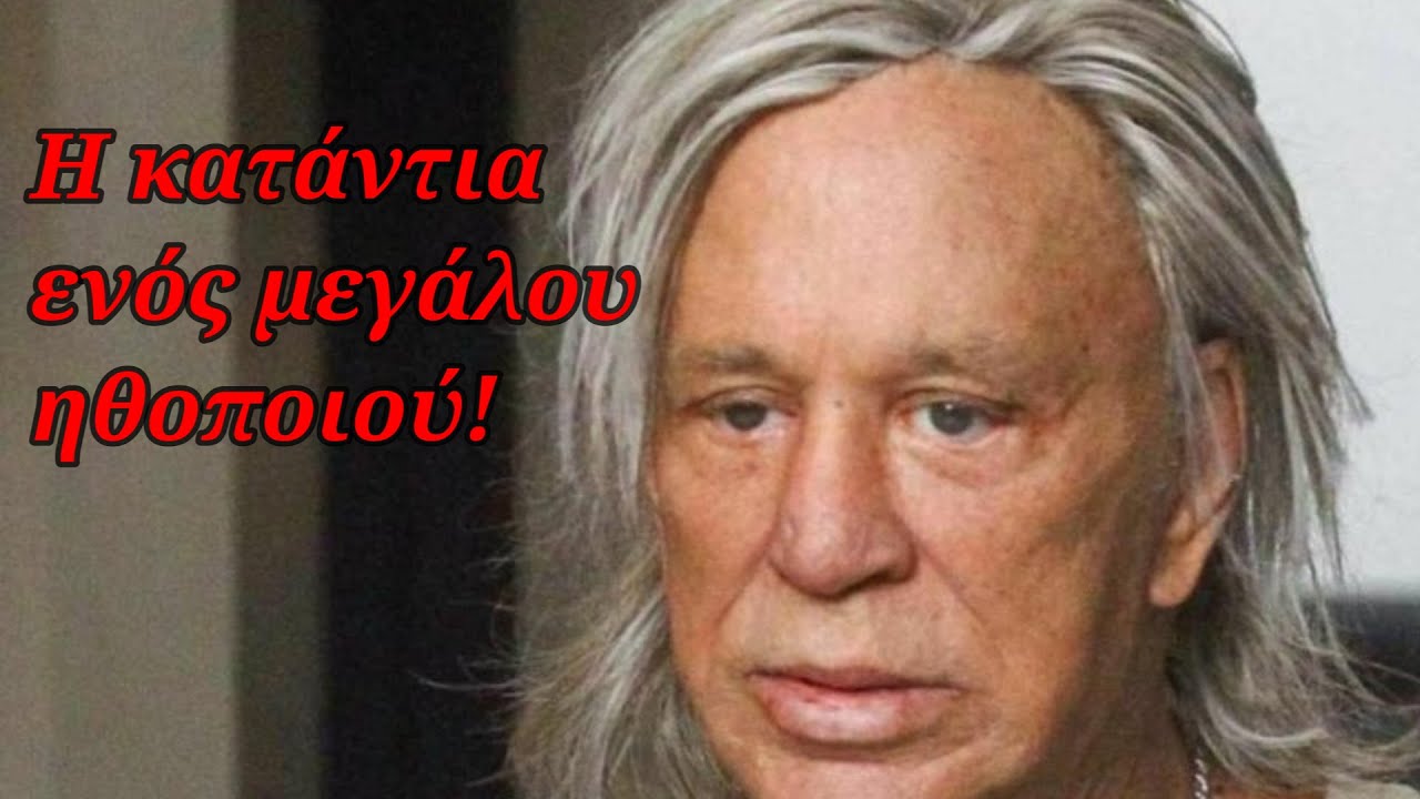 Η σοκαριστική εικόνα και ζωή, ενός σταρ - Το αλκοόλ οι ουσίες και οι πλαστικές τον έκαναν σαν τέρας!