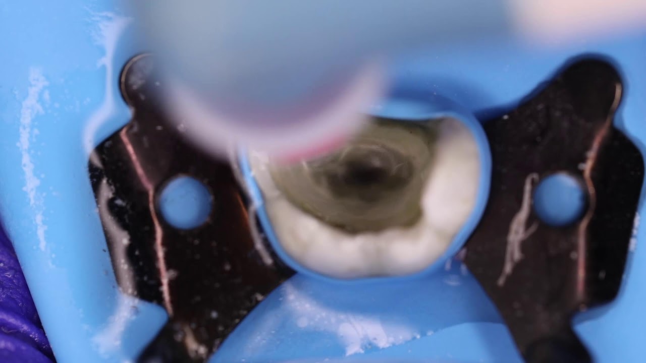 Access Preparation & Cleaning & Shaping 🔵 Maxillary Molar with Single Root ⚪️ Now live streaming