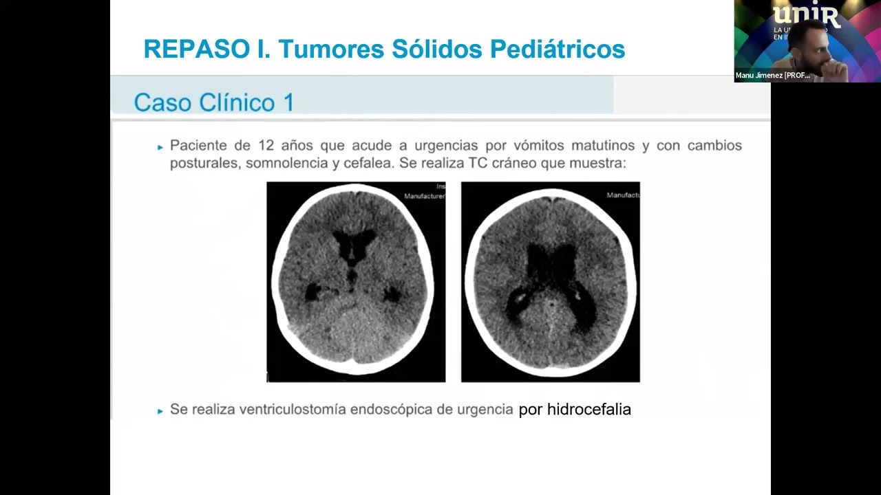 Repaso 1 Tumores Sólidos Pediátricos I