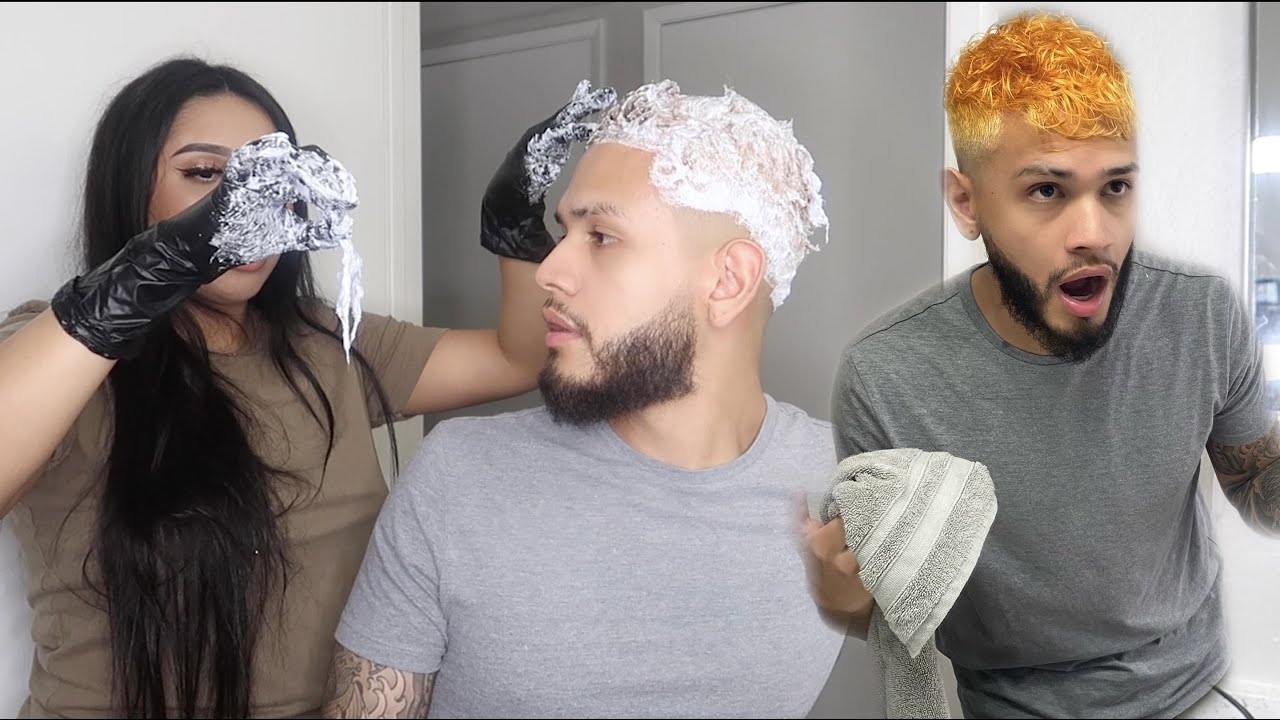 YOUR HAIR IS FALLING OUT PRANK + SURGERY UPDATE!