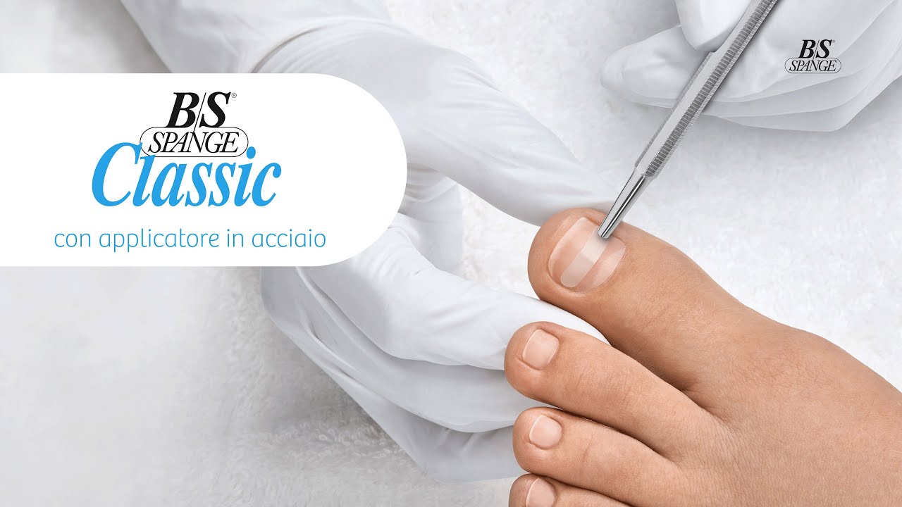 B/S Spange | Istruzioni per l'applicazione delle graffette Classic con l'applicatore in acciaio