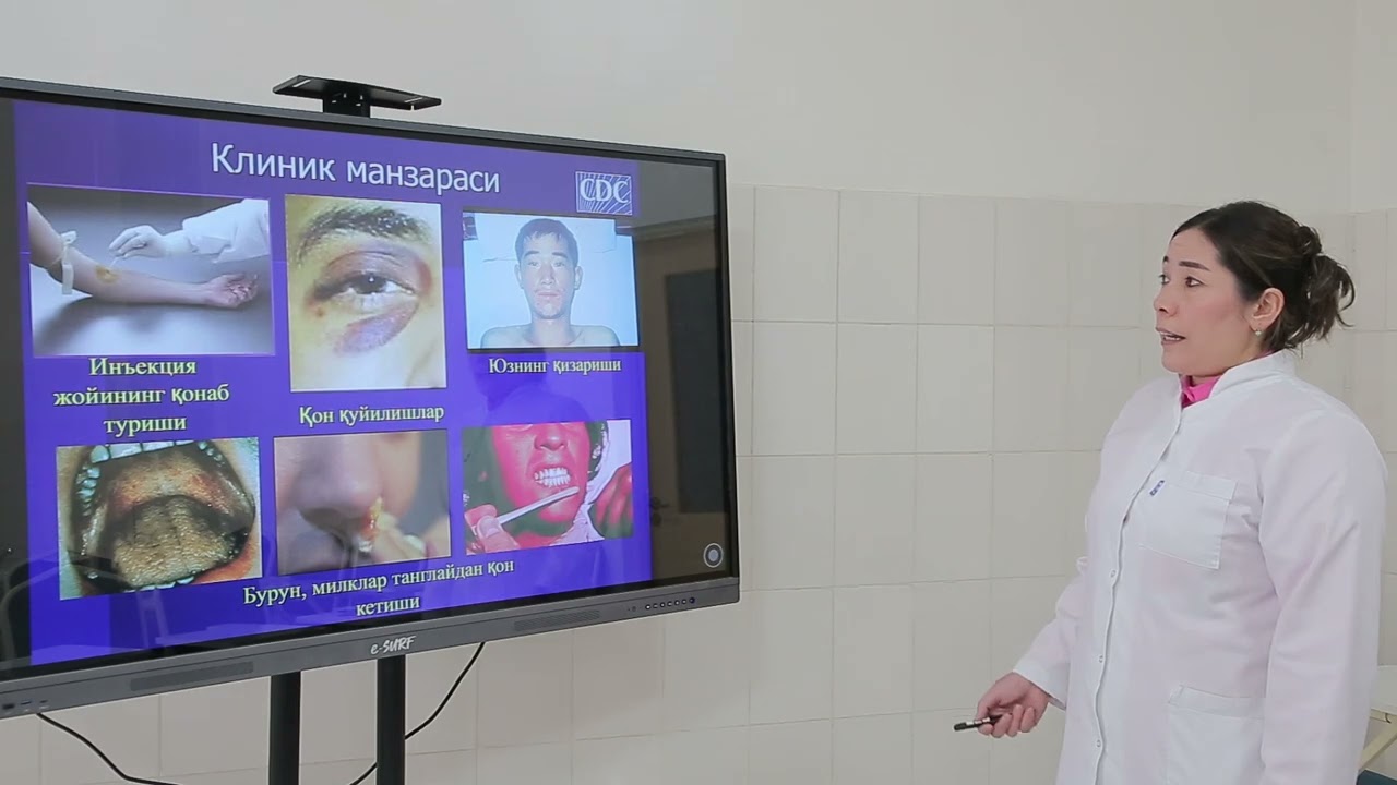 O’ta xavfli kasalliklar, etiologiyasi, epidemiologiyasi, tasnifi, profilaktikasi