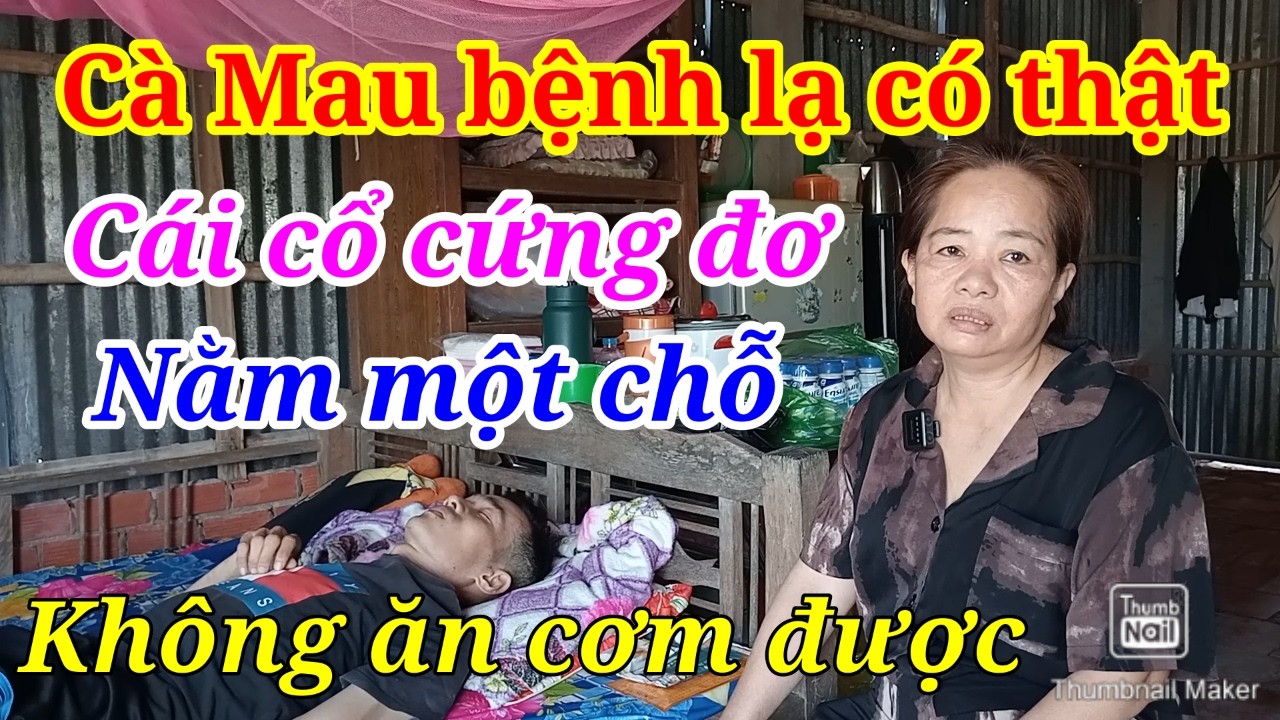 Bệnh Lạ Cà Mau Cổ Cứng Đơ Ăn Cơm Không Được Nằm Một Chỗ