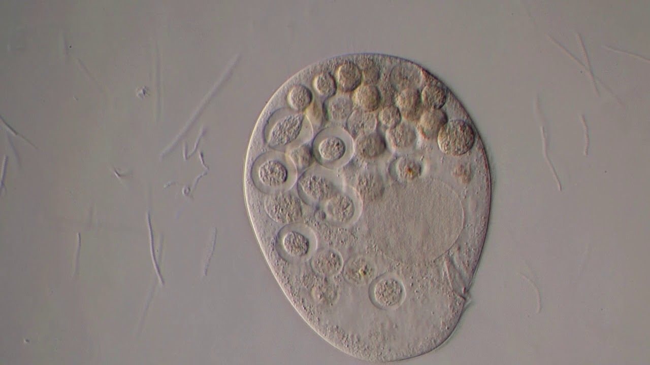 Microscopic World - Protozoa