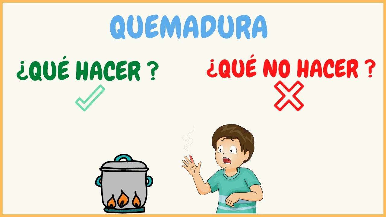 QUEMADURA EN NIÑOS ¿QUÉ TIENES QUE HACER Y QUÉ NO TIENES QUE HACER?
