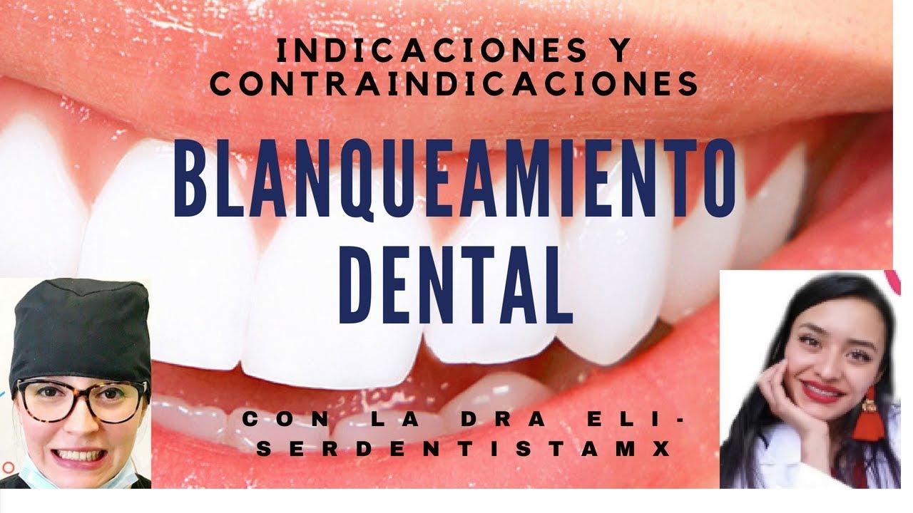Indicaciones y Contraindicaciones del BLANQUEAMIENTO DENTAL ft SerDentistaMx