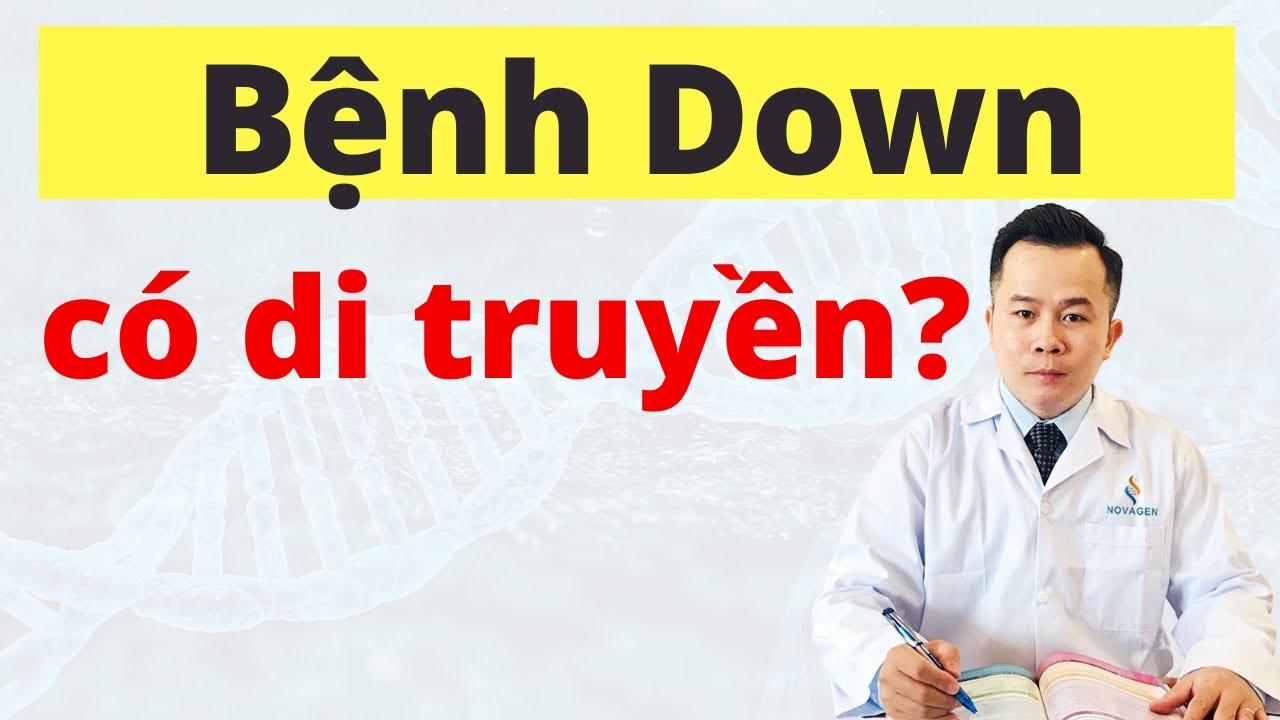 5 Sự Thật Quan Trọng Về Bệnh Down Bạn Cần Phải Biết? Bệnh Down Có Di Truyền Không?