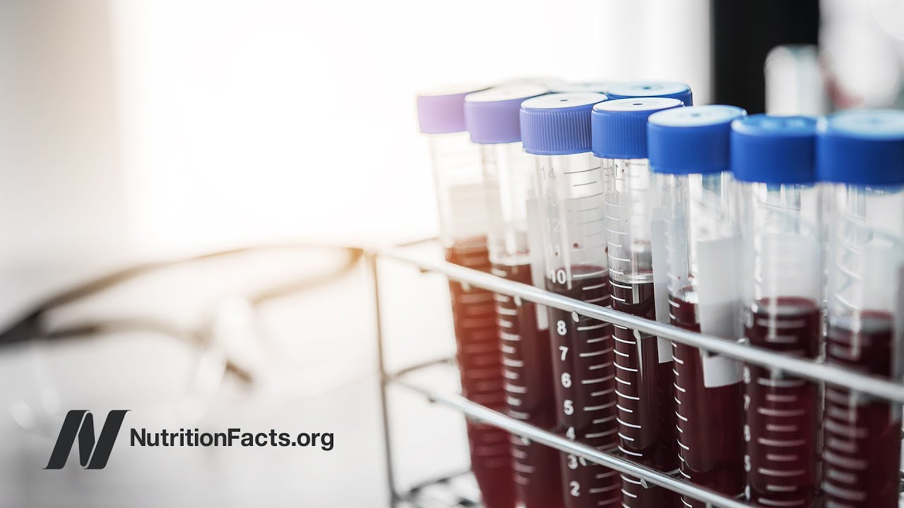 Donating Blood to Prevent Cancer?