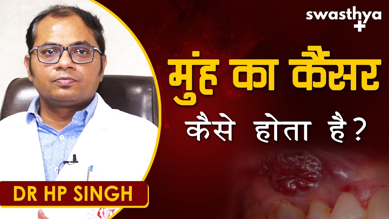 मुँह का कैंसर क्यों होता है? लक्षण, बचाव | Dr HP Singh on Oral Cavity Cancer in Hindi | Prevention
