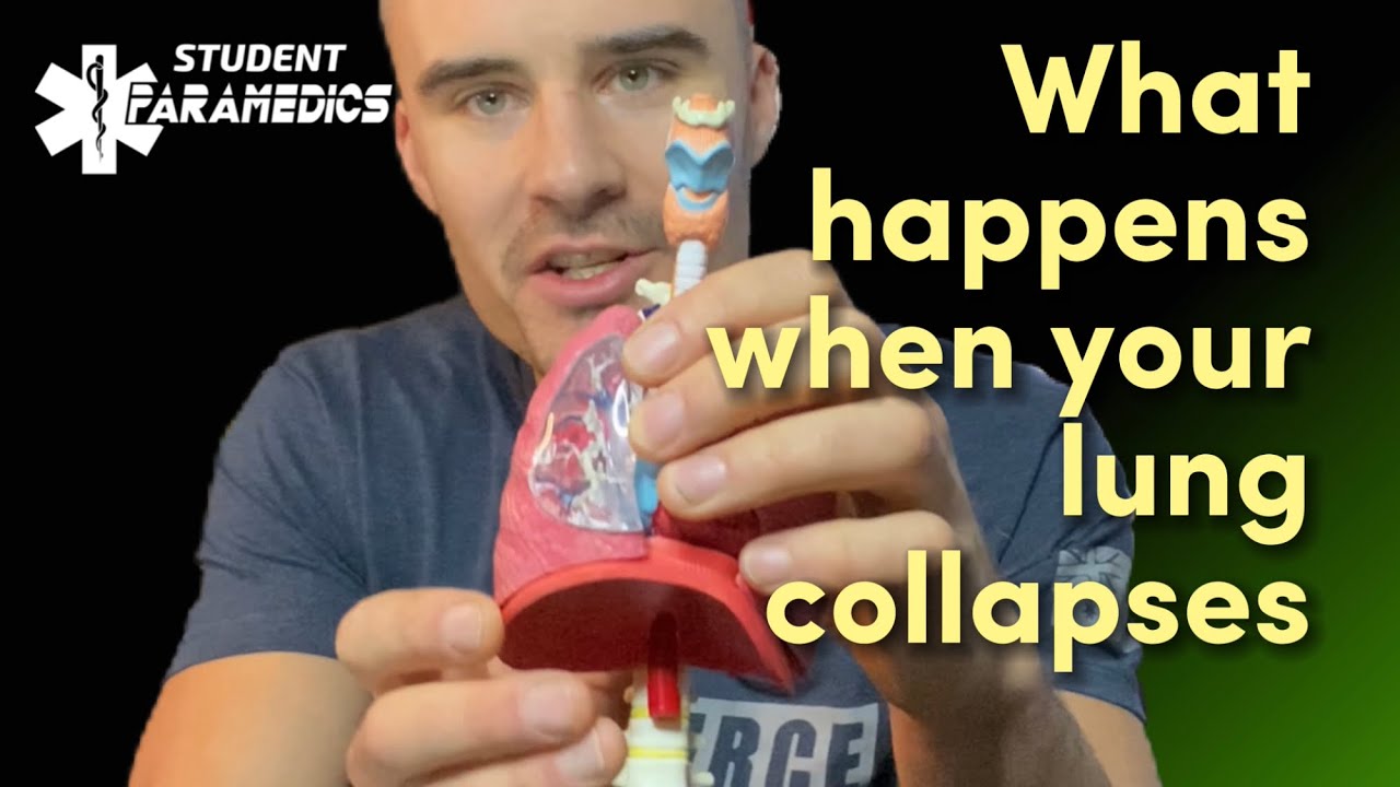 This is what happens when your lung collapses