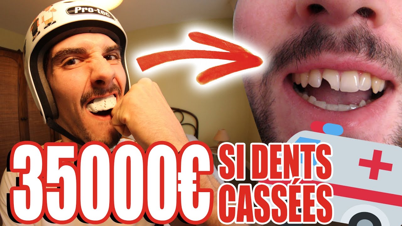 JE GAGNE 35000€ SI JE ME CASSE LES DENTS | MEILLEUR PROTÈGE DENTS DU MONDE