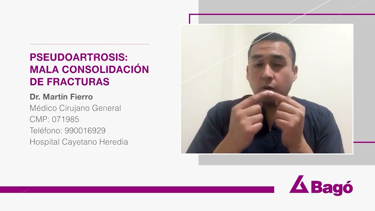 PSEUDOARTROSIS: MALA CONSOLIDACIÓN DE FRACTURAS