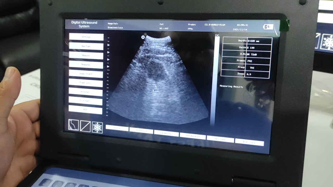 ULTRASONOGRAFO CONTEC CMS600P2 PARTE 3