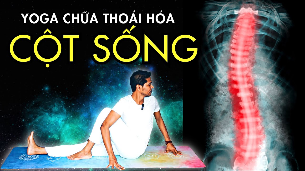 Yoga cho Chứng Vẹo Cột Sống | Bài Tập Hiệu Quả để Cải Thiện Cột Sống