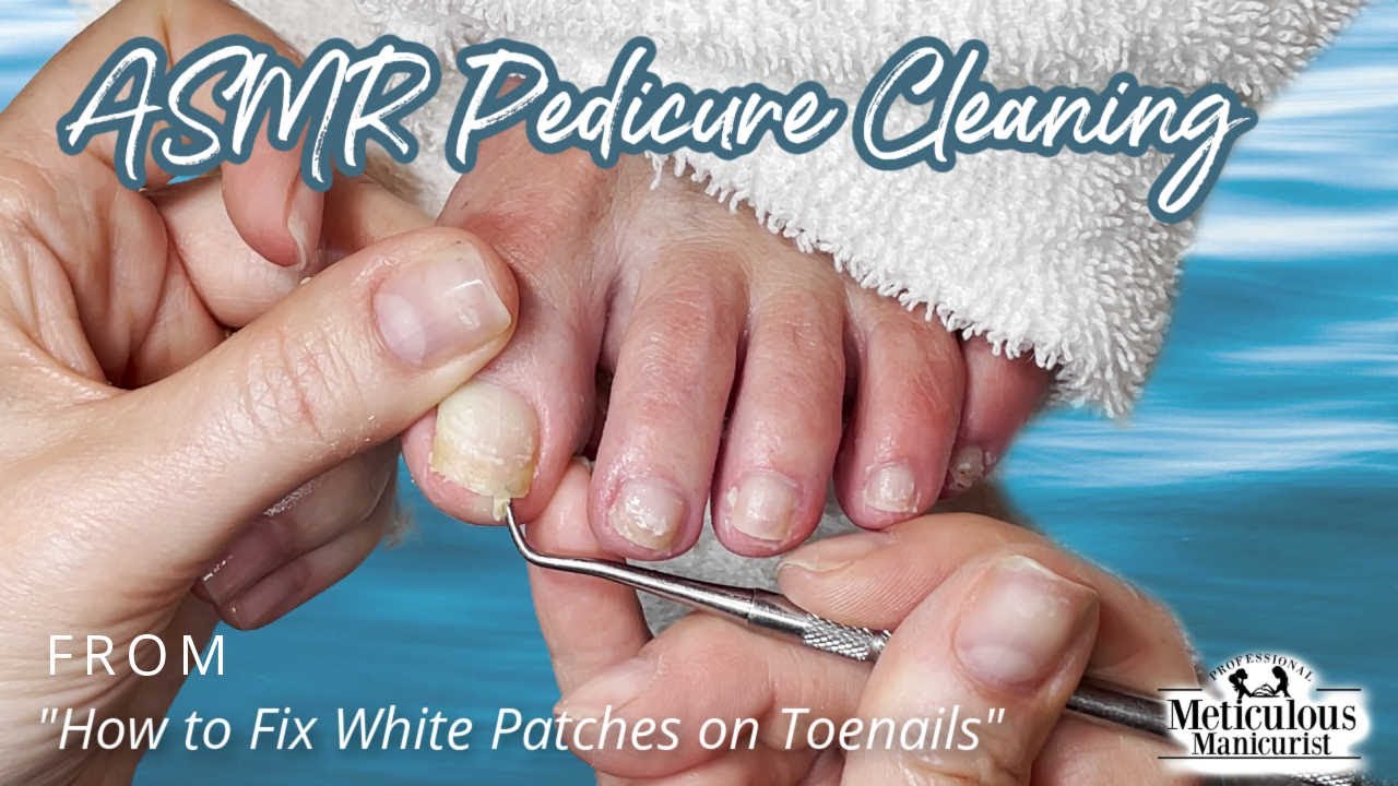 👣ASMR Pedicure Cleaning💆&zwj;♀️How to Fix White Patches on Toenails👣