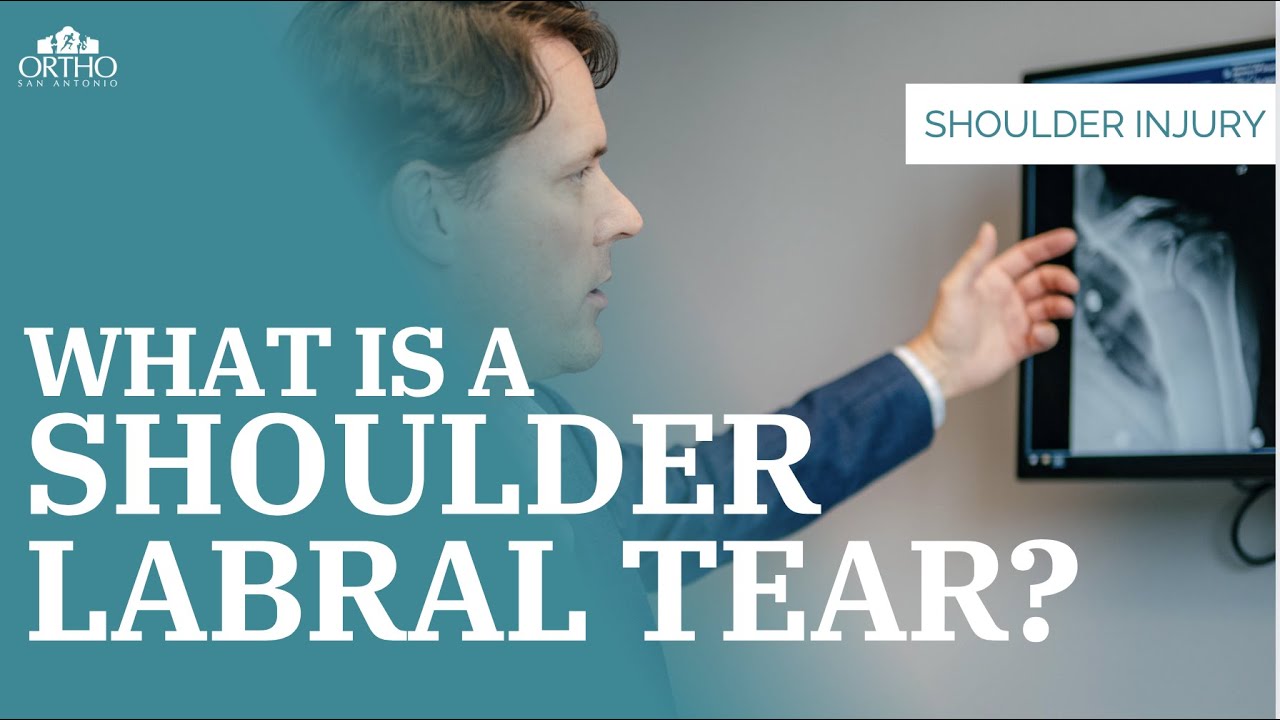What Is A Shoulder Labral Tear?