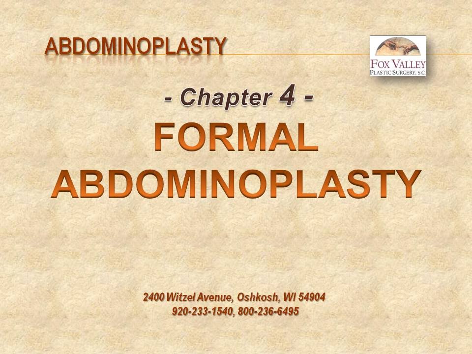 FVPS Abdominoplasty - Chapter 4