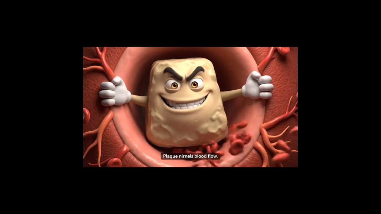&ldquo;Stop Artery Damage Before It Starts! Antioxidants to the Rescue  #Antioxidants #ArteryProtection