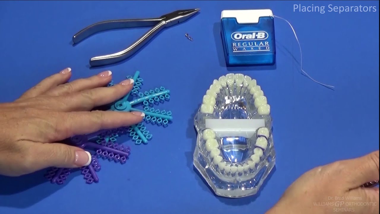 Straight Wire Orthodontics Spacers Demo