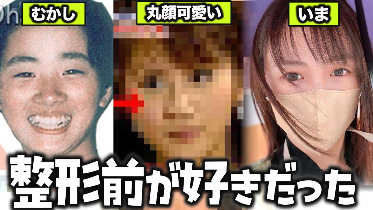 【ガルちゃん芸能】可愛かったのに… 終わりなき整形の闇 【ゆっくり解説】