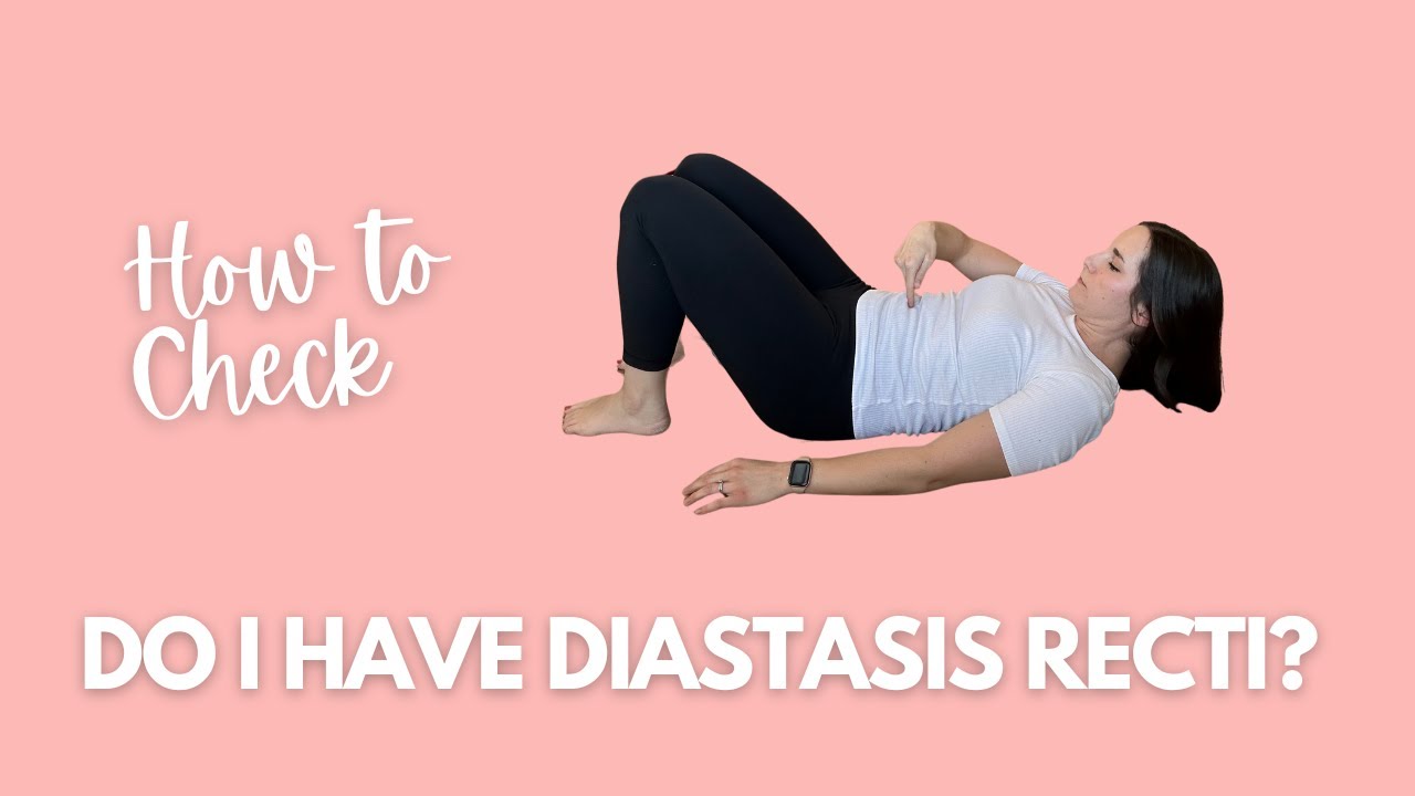 Do I Have Diastasis Recti? How to Check Yourself
