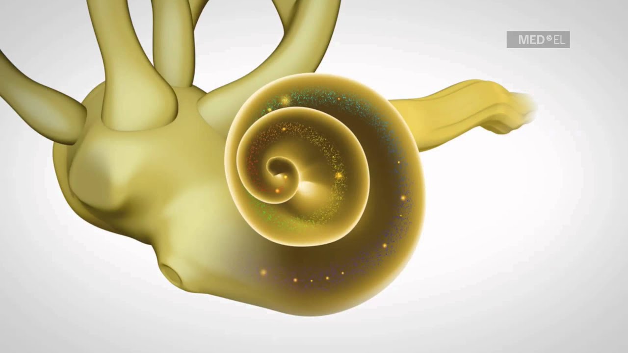 Schallempfindungsschwerhörigkeit tritt in der Cochlea auf