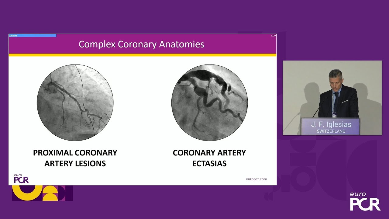 Innovative approaches to thrombus removal: redefining acute thromboembolic management in ACS