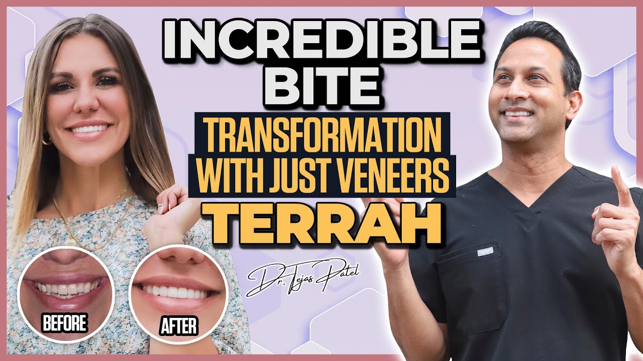 Entrepreneur gets shocked😱 after getting Veneers by Celebrity Dentist! | Smile Transformation