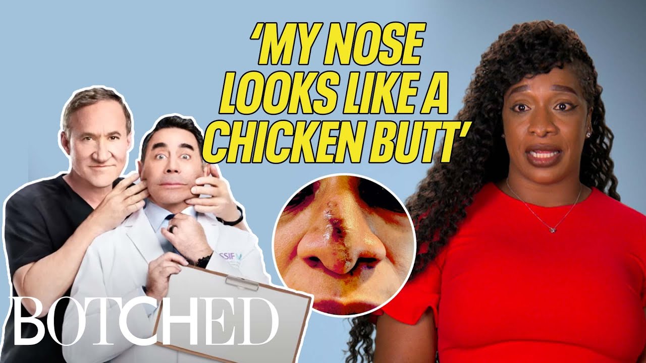 Cadine's Nose Looks Like a 'CHICKEN BUTT'?! (Before & After) | Botched | E!