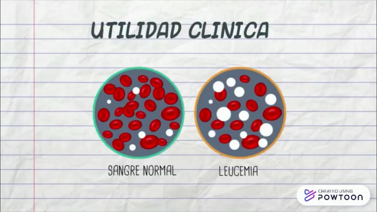 Citometría de flujo