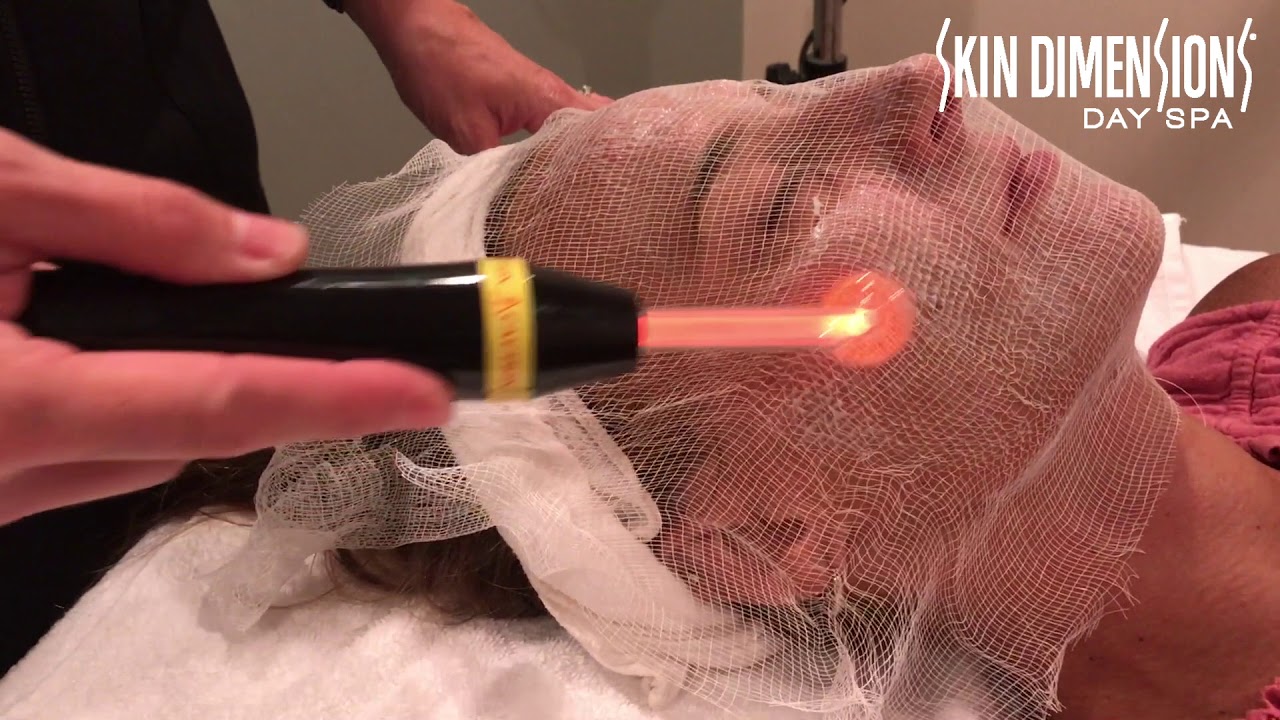 High Frequency Treatment at Skin Dimensions Day Spa
