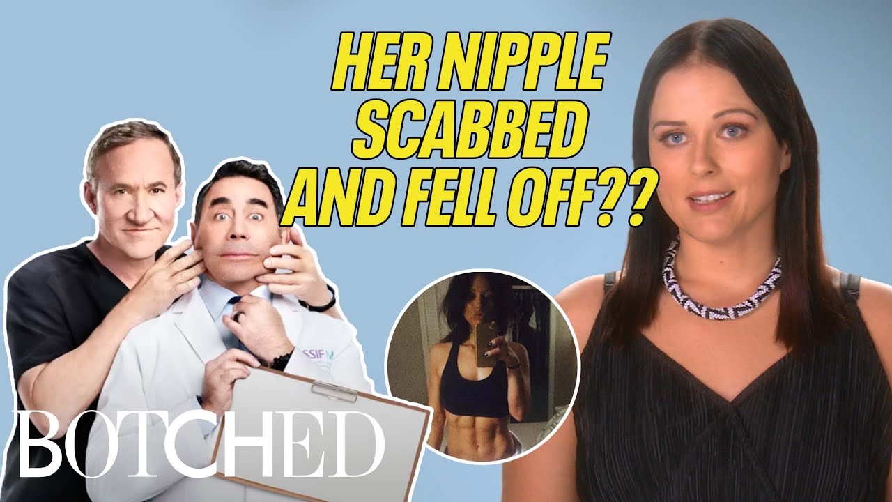 Jessica's Nipple Scabbed And FELL OFF After Breast Implants?! | Botched | E!