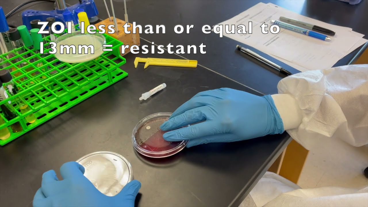 Optochin and Bile Solubility
