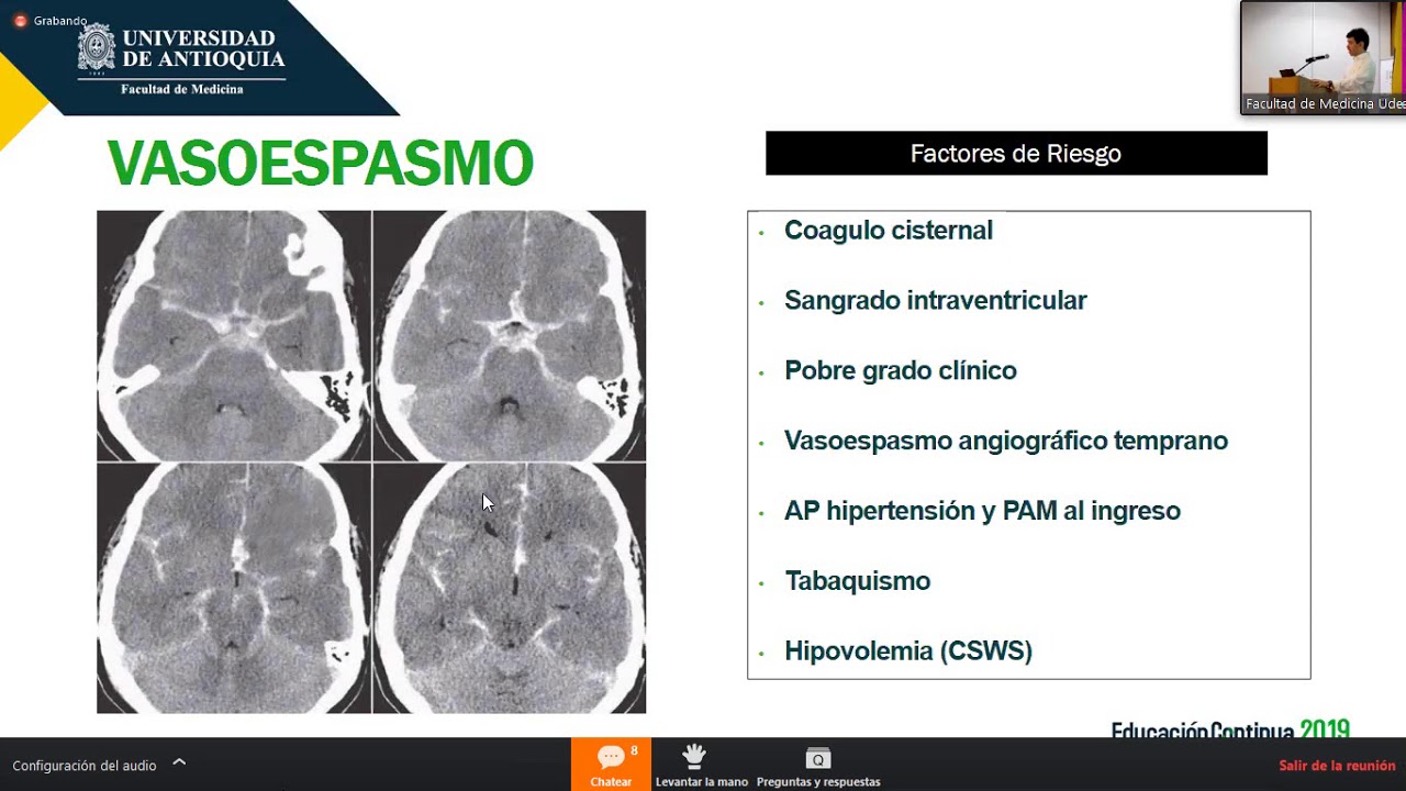 4  ACV  hemorragico