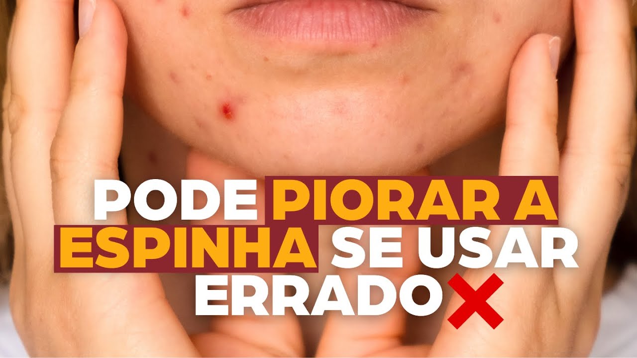 Como usar curativo para acne