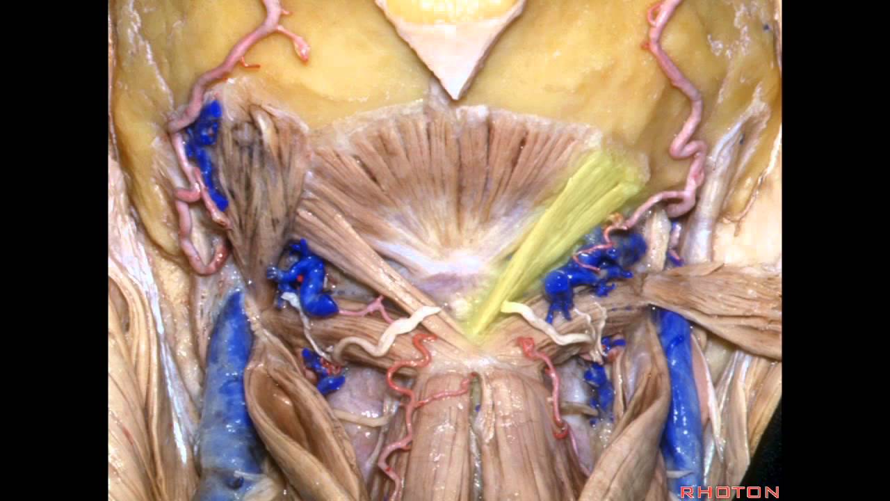 Far Lateral Approach and Jugular Foramen - Part 1 of 2
