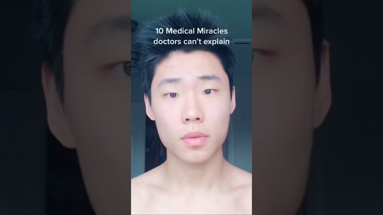 MEDICAL MIRACLES That Doctors Can&rsquo;t Explain!! pt.1 #shorts