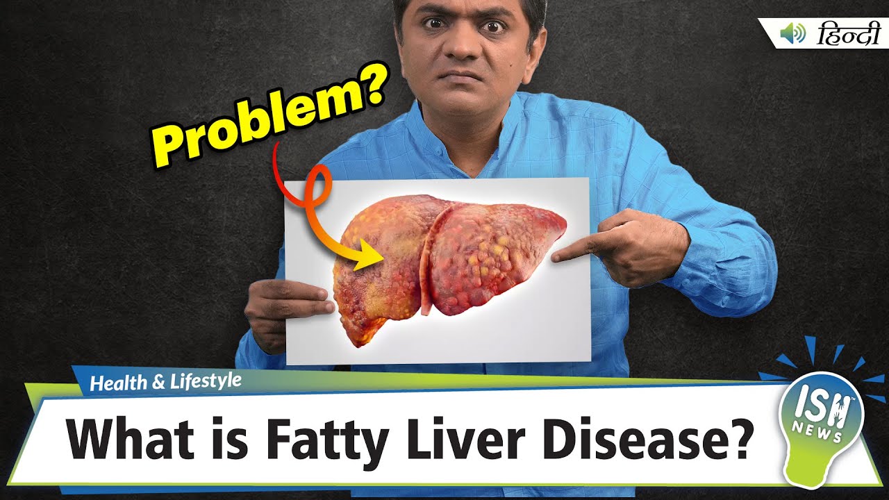 What is Fatty Liver Disease?  | ISH News