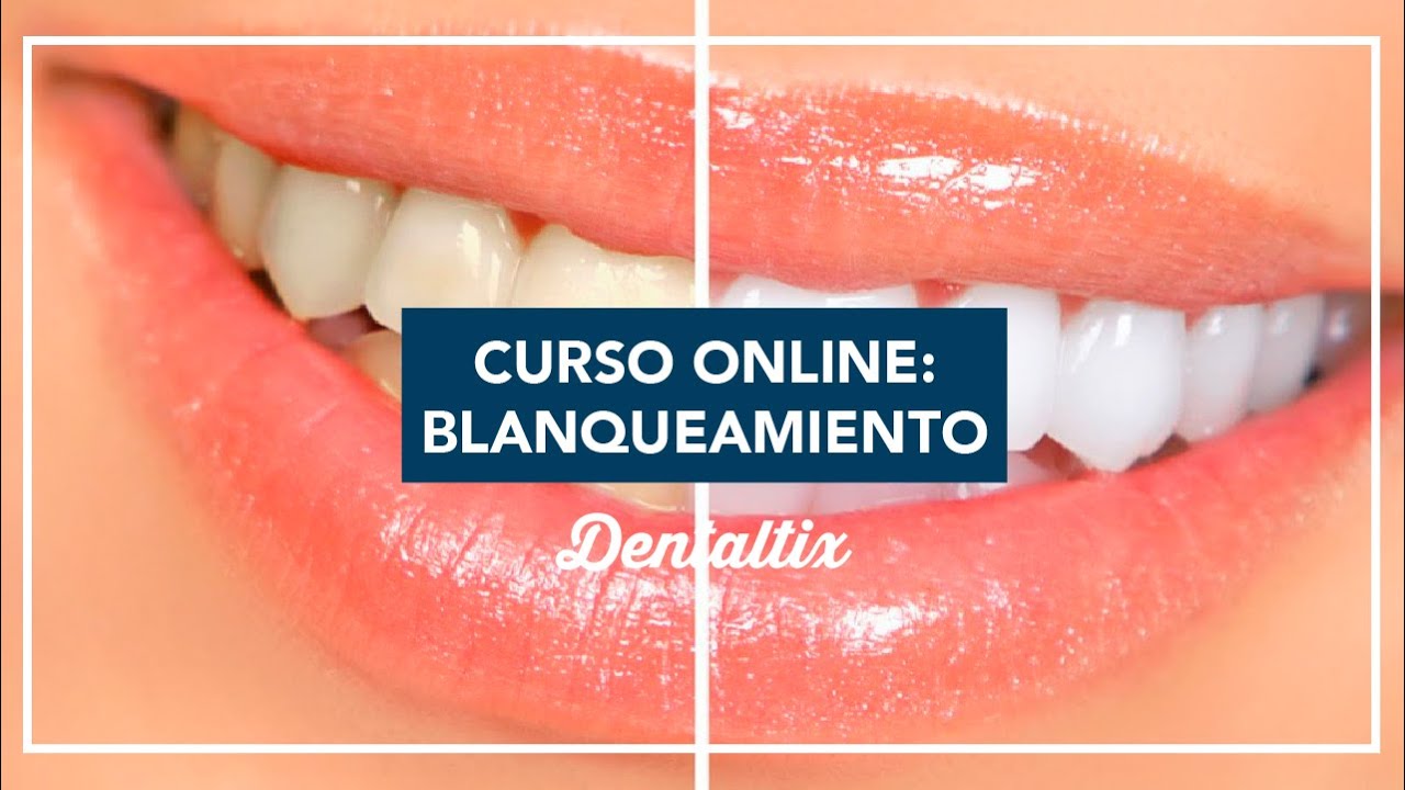 Curso online de Blanqueamiento Dental impartido por el Dr. Amengual.