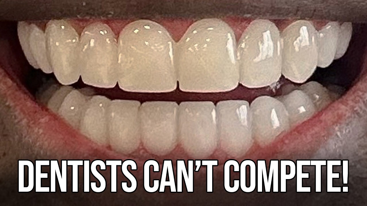 Perfect Teeth - 7 Day Smile Makeovers for Less than $1,000 - Brighter Image Lab Dental Veneers