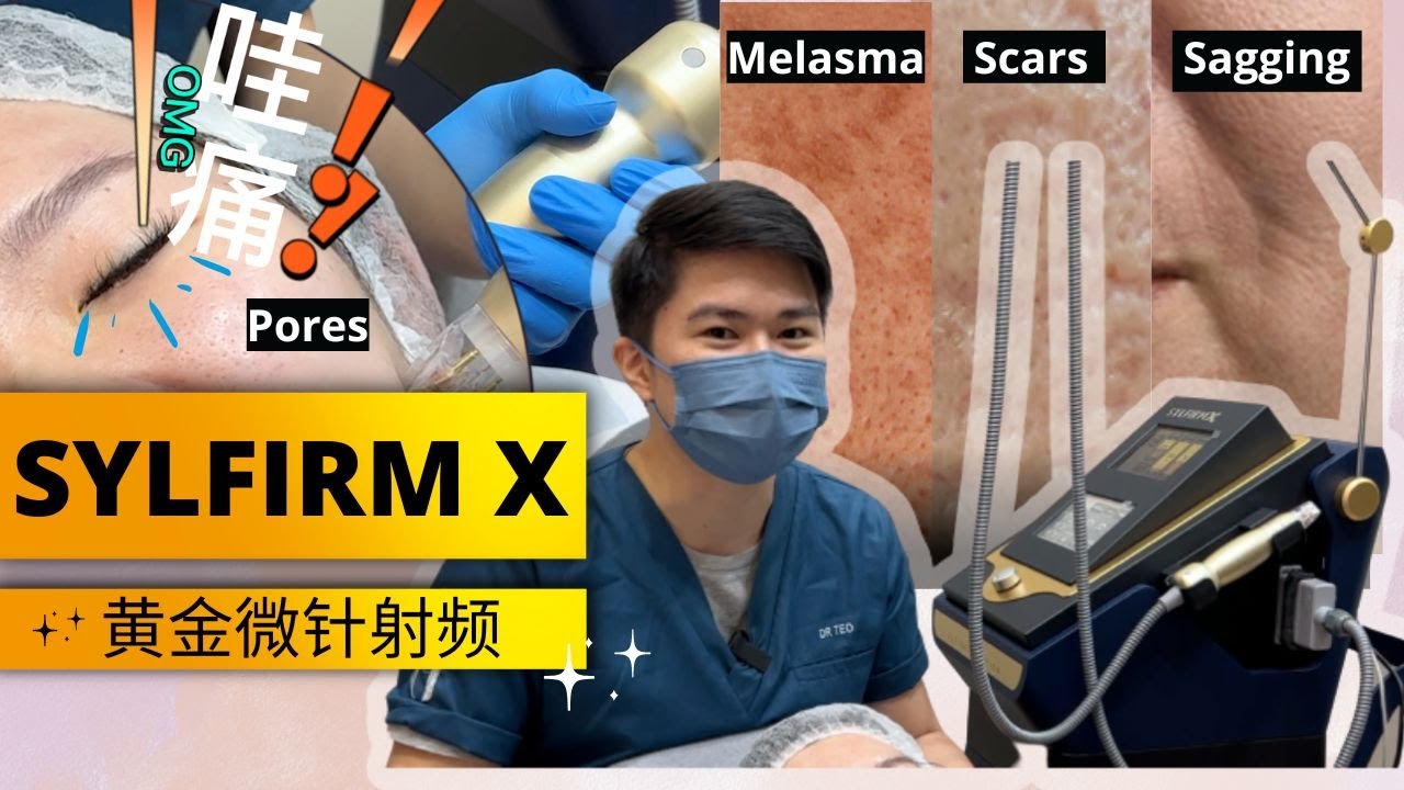 How to treat Melasma, Acne-scars, sagging skin ?| SYLFIRM X MALAYSIA (如何改善黄褐斑，痘疤，皮肤松弛? | 黄金微针射频)