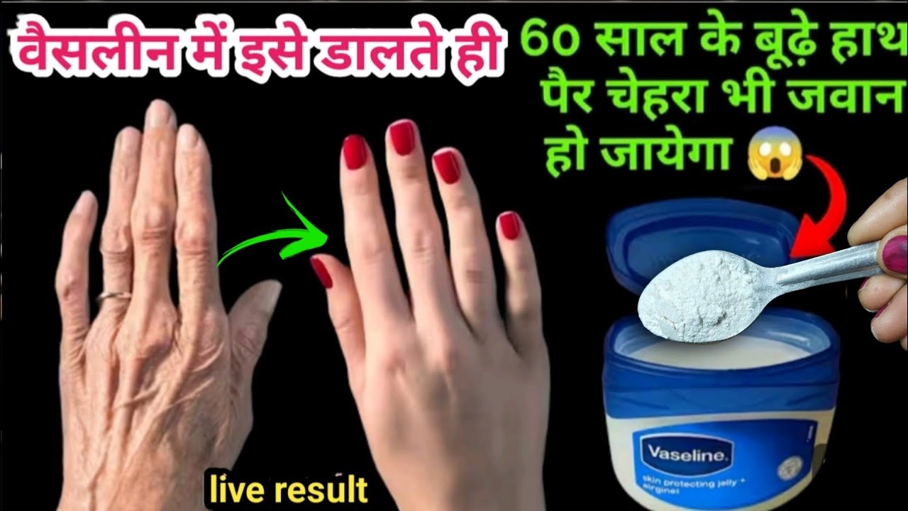 इस तरह से अपने चेहरे पर वैसलीन लगाएं और आपका चेहरा इतना गोरा हो जाएगा कि हर कोई देखेगा...