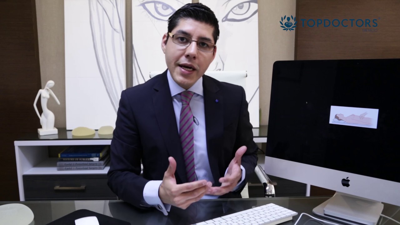 Abdominoplastia – Dr. Maximiliano Martínez