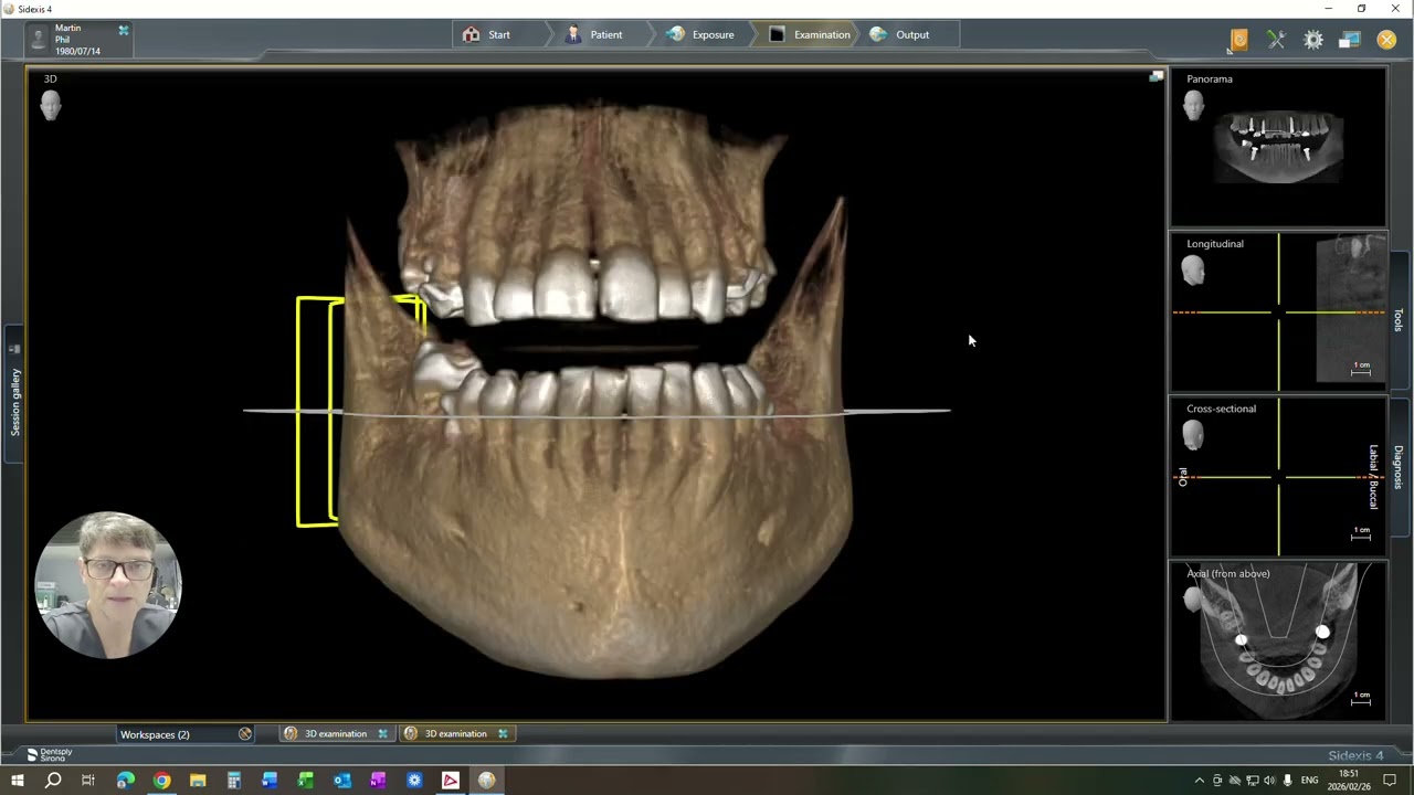 Case of the Month - from the Implant case transformation