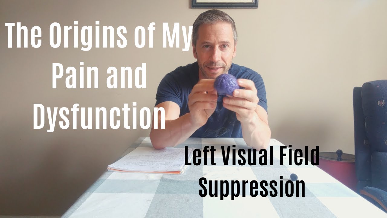 The Origin of My Pain Discovered: Suppression of My Left Visual Field