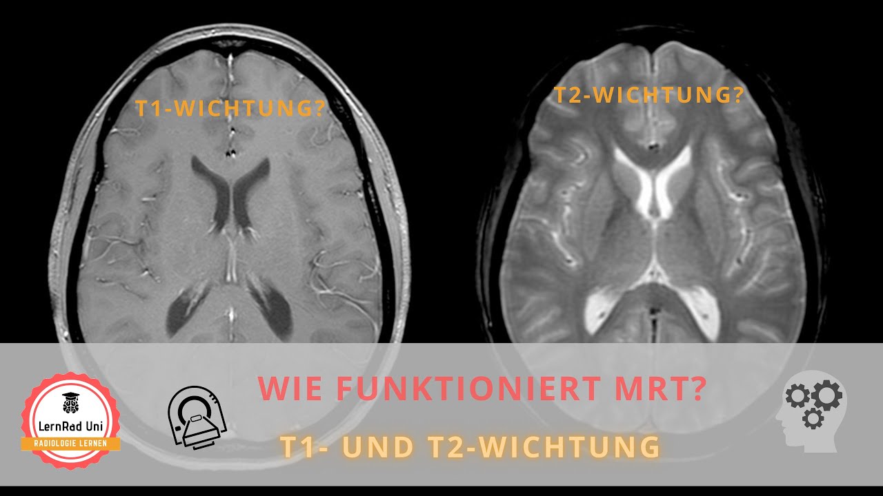 Wie funktioniert MRT? T1- und T2-Wichtung verständlich erklärt